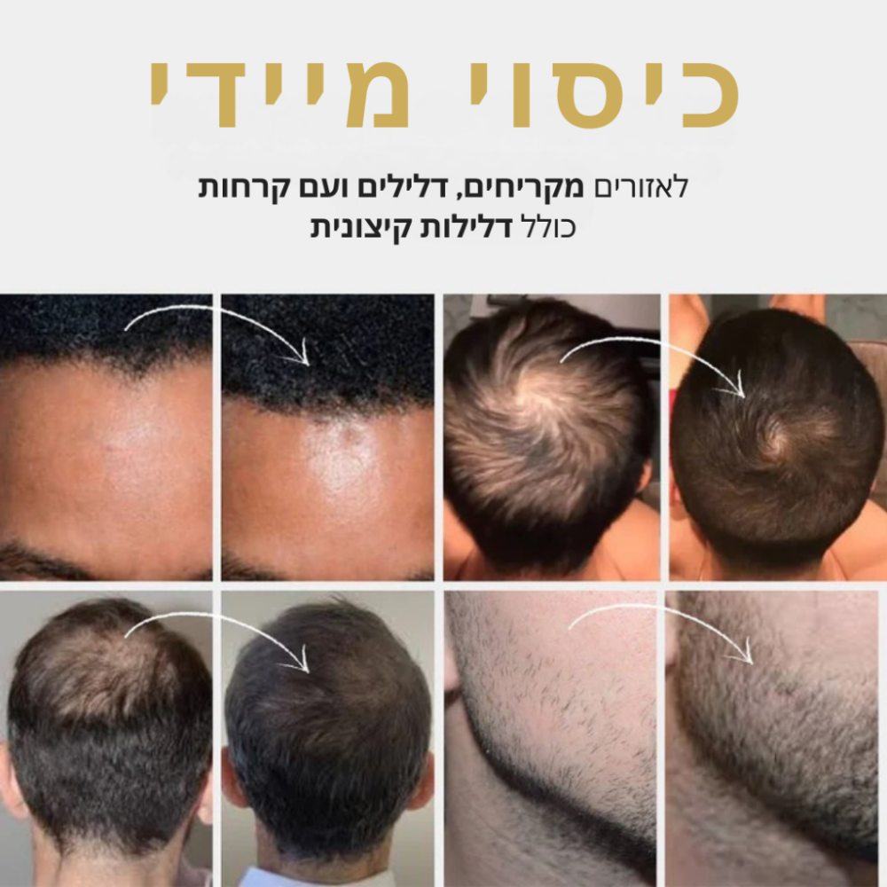 Manle – אבקת שיער